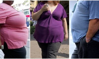 obesidade-pode-reduzir-em-ate-dez-anos-a-expectativa-de-vida